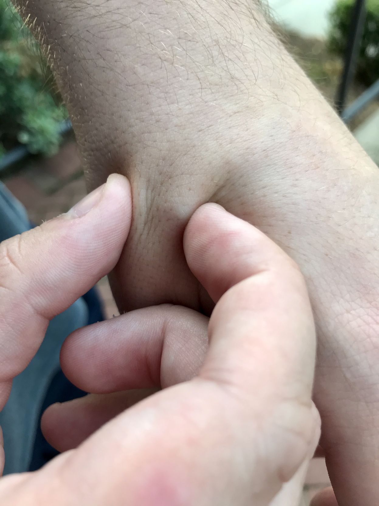 microchip